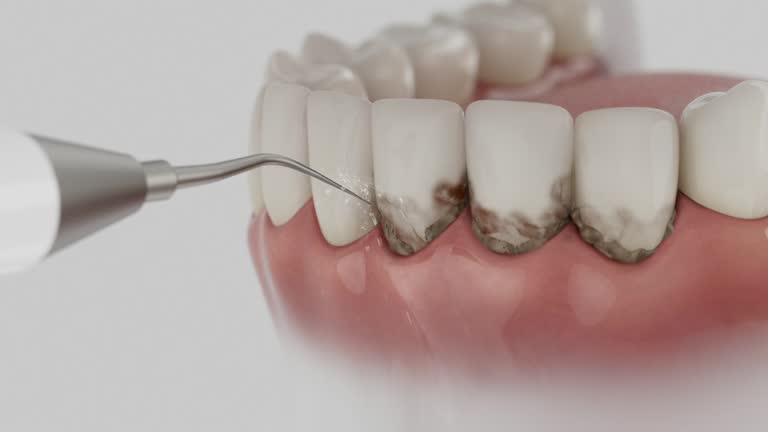 Trusted Tooth Extraction service in Rawls Springs, MS - Dentist Open Now